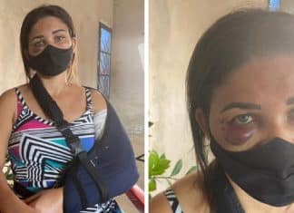 Funcionária de padaria é agredida depois de pedir que cliente usasse máscara