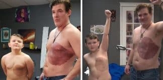 Pai passou 30 horas fazendo tatuagem para que filho se sinta melhor com marca de nascença Pai passou 30 horas fazendo tatuagem para que filho se sinta melhor com marca de nascença