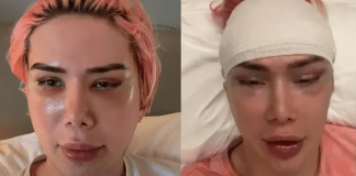 Influencer britânico faz 18 cirurgias e gasta US$ 150 mil para se parecer com cantor coreano