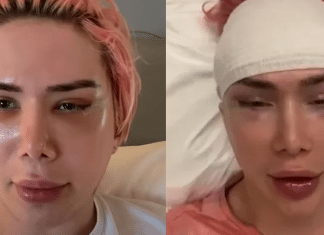 Influencer britânico faz 18 cirurgias e gasta US$ 150 mil para se parecer com cantor coreano