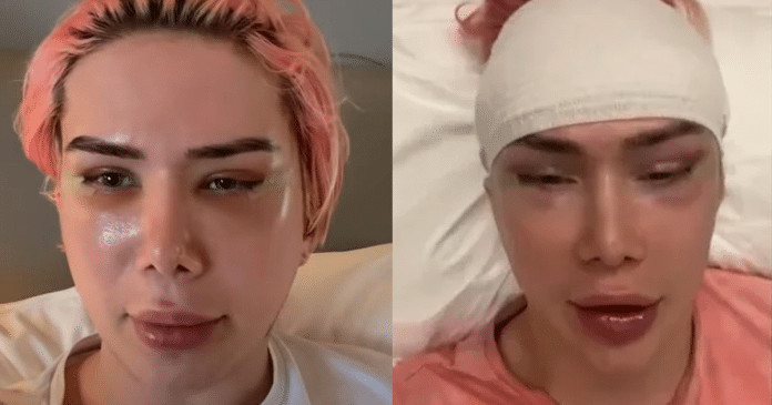 Influencer britânico faz 18 cirurgias e gasta US$ 150 mil para se parecer com cantor coreano