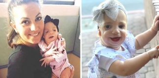 “Ninguém me deu os parabéns pela chegada da minha filha”: Mãe acusa rejeição de seu bebê com síndrome rara