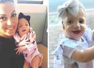 “Ninguém me deu os parabéns pela chegada da minha filha”: Mãe acusa rejeição de seu bebê com síndrome rara