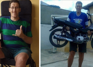 Homem mais alto do Brasil terá que amputar perna: ‘decisão dura e dolorosa’