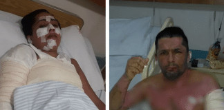 Sem gás, família se queima gravemente ao usar álcool para cozinhar e vai parar no hospital