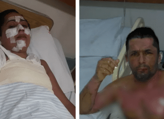 Sem gás, família se queima gravemente ao usar álcool para cozinhar e vai parar no hospital