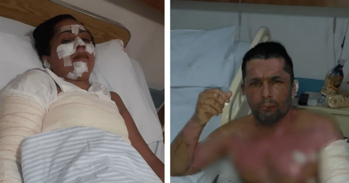 Sem gás, família se queima gravemente ao usar álcool para cozinhar e vai parar no hospital