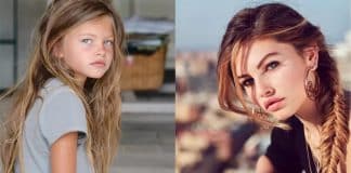 Hoje com 20 anos, menina considerada a ‘mais bonita do mundo’ vive drama