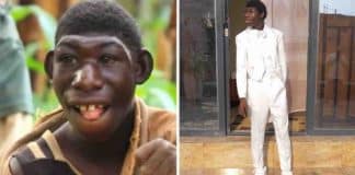 Menino com microcefalia que sofreu bullying por causa de sua aparência dá a volta por cima