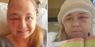 Professora passou por cirurgia no cérebro e no dia seguinte leu uma história para seus alunos