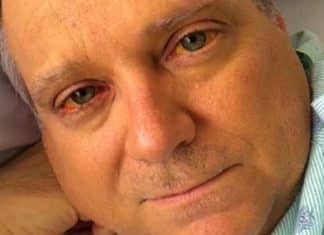 ‘Um suplemento alimentar me pôs na fila do transplante de fígado’