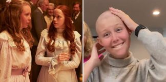 Com câncer de mama aos 19 anos, atriz de “Anne With an E” retira os dois seios