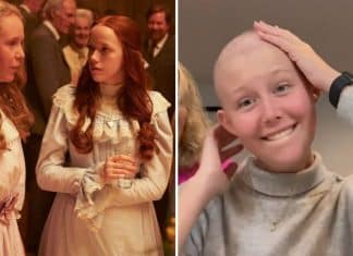 Com câncer de mama aos 19 anos, atriz de “Anne With an E” retira os dois seios