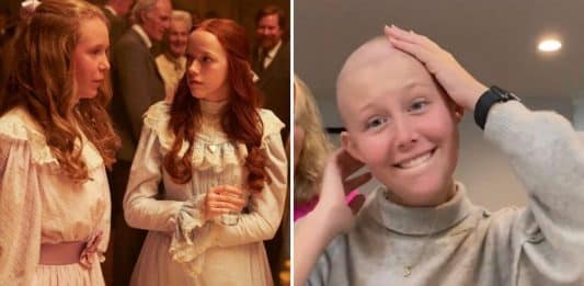 Com câncer de mama aos 19 anos, atriz de “Anne With an E” retira os dois seios