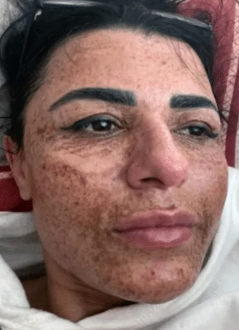 contioutra.com - Mulher tem rosto queimado ap&oacute;s esteticista distrair-se com celular
