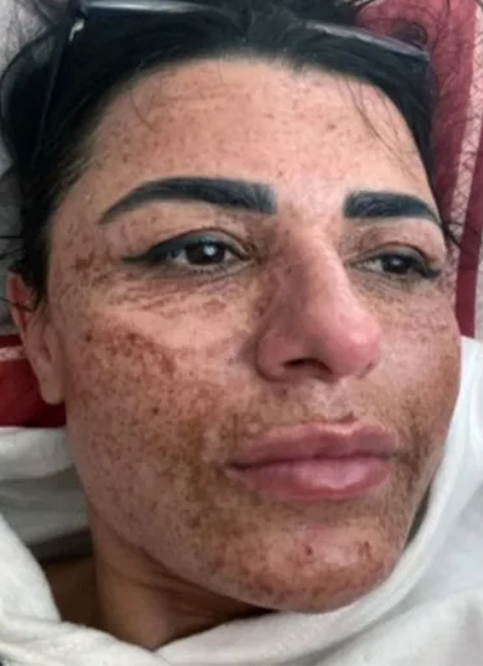 contioutra.com - Mulher tem rosto queimado após esteticista distrair-se com celular
