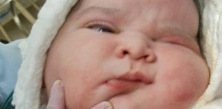 ‘Bebê gigante’ nasce com mais de 6,5 quilos na cidade de Presidente Prudente (SP)