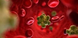 Mulher de 64 anos é considerada curada do HIV depois de transplante de células-tronco