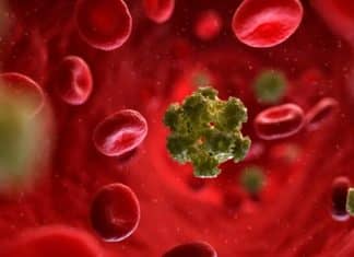 Mulher de 64 anos é considerada curada do HIV depois de transplante de células-tronco