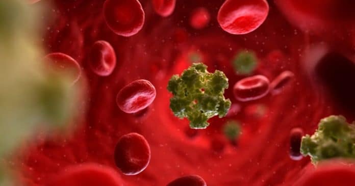 Sem Título-1 Mulher de 64 anos é considerada curada do HIV depois de transplante de células-tronco