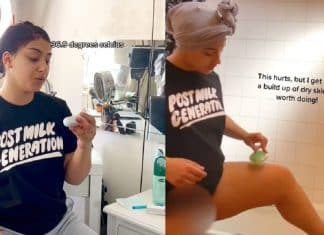 Jovem alérgica à água compartilha nas redes sociais a sua difícil rotina de banho