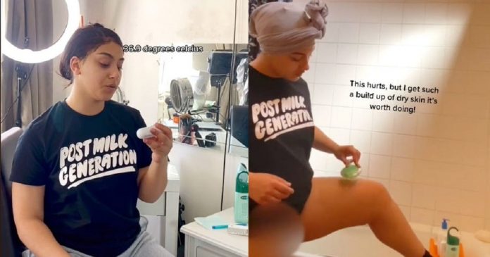 Jovem alérgica à água compartilha nas redes sociais a sua difícil rotina de banho