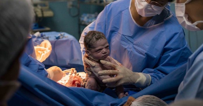 Fotógrafo responsável pela foto da ‘bebê brava’ reencontra a garotinha 2 anos depois