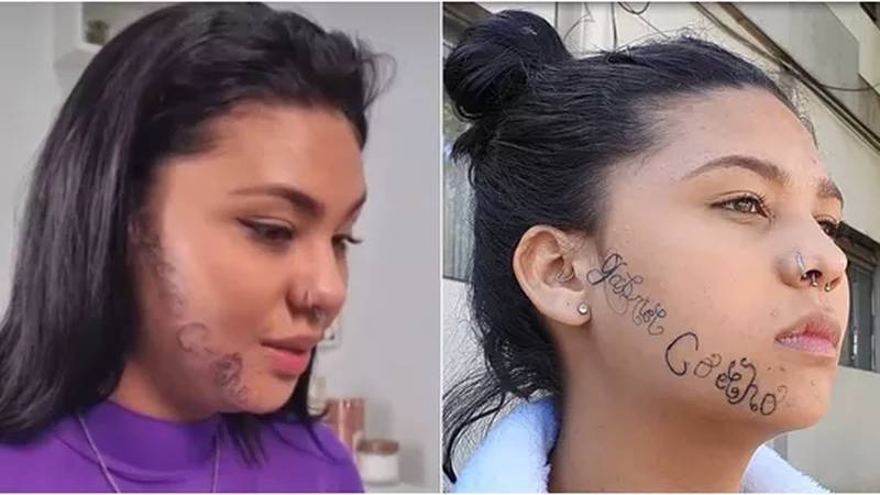 contioutra.com - Tayane Caldas inicia remoção da tatuagem e desabafa: "Me sinto livre"