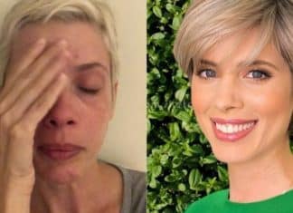 Dani Valente mostra efeitos da fibromialgia ao comparar fotos antigas e atuais