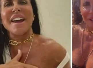 Gretchen aparece com pelos no peito e nos braços e dá exemplo de amor próprio