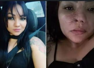 “Eu choro, não é fácil o que eu vivo hoje”, diz mulher após cirurgia estética com dentista