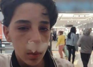 ‘Apaguei’, diz adolescente que acusa segurança de shopping de SP de quebrar seu nariz
