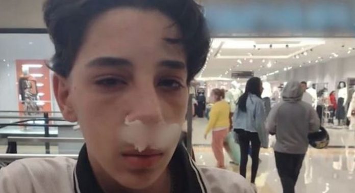 ‘Apaguei’, diz adolescente que acusa segurança de shopping de SP de quebrar seu nariz