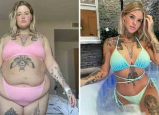 “Dinheiro traz sim felicidade”, diz mulher que gastou mais de R$100 mil em cirurgias para se sentir “bonita”