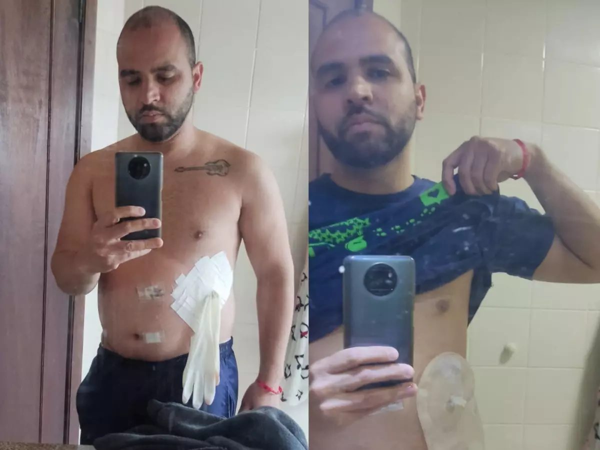 contioutra.com - Médico é demitido após improvisar bolsa de colostomia com luva cirúrgica no PR