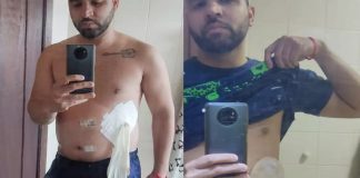 Médico é demitido após improvisar bolsa de colostomia com luva cirúrgica no PR