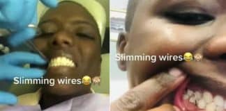 Mulher ‘tranca os dentes’ para conseguir emagrecer e passar por cirurgia