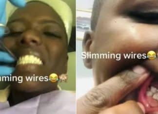 Mulher ‘tranca os dentes’ para conseguir emagrecer e passar por cirurgia