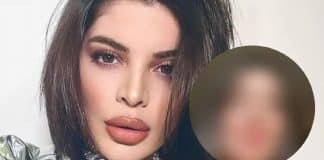 Gkay retira o preenchimento labial e fãs se impressionam: ‘Muito mais linda natural’