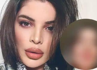 Gkay retira o preenchimento labial e fãs se impressionam: ‘Muito mais linda natural’