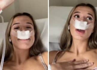 Jovem diz que fez rinoplastia para que seus filhos herdem “um nariz bonito”