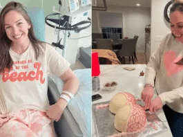 “Meu biquíni salvou minha vida”: diz mulher que descobriu câncer de maneira inusitada