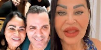Mãe de Eduardo Costa faz harmonização facial e quer ser influencer