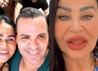 Mãe de Eduardo Costa faz harmonização facial e quer ser influencer