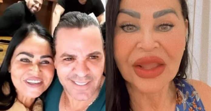 capa Mãe de Eduardo Costa faz harmonização facial e quer ser influencer