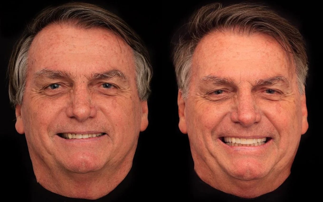 contioutra.com - Bolsonaro passa por harmonização facial e coloca dentes de R$ 88 mil; compare antes e depois