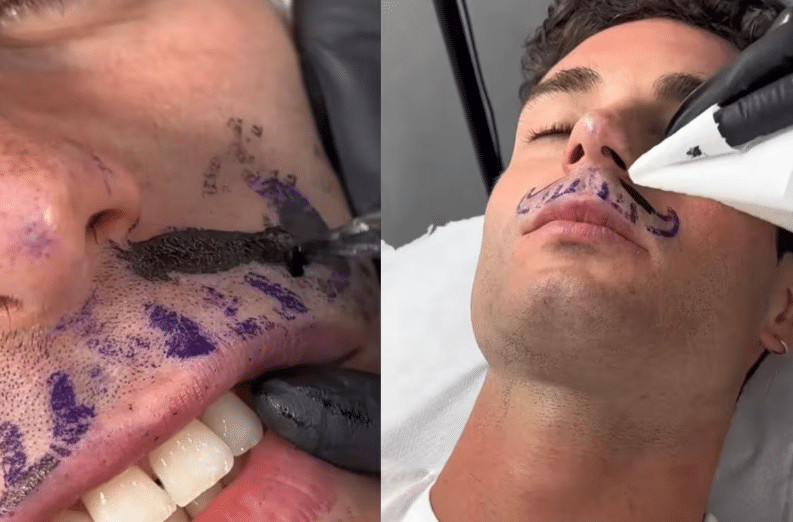 contioutra.com - Rapaz tira o bigode para fazer tatuagem de bigode e viraliza