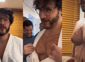 Eliezer exibe resultado de cirurgia de redução de mamas; confira