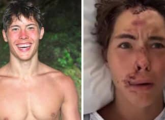 Influenciador faz relato chocante após cair de penhasco em lava de vulcão