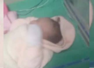 Bebê que teve a cabeça cortada no parto pode ter sequela neurológica permanente